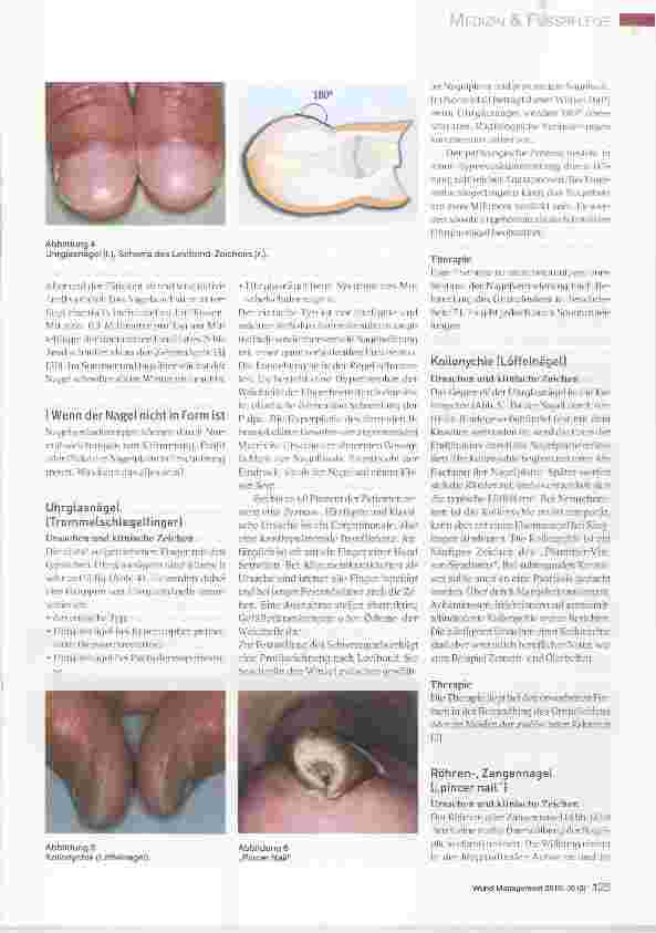 Vorschauseite 2: Ursachen und Therapie von Nagelerkrankungen
