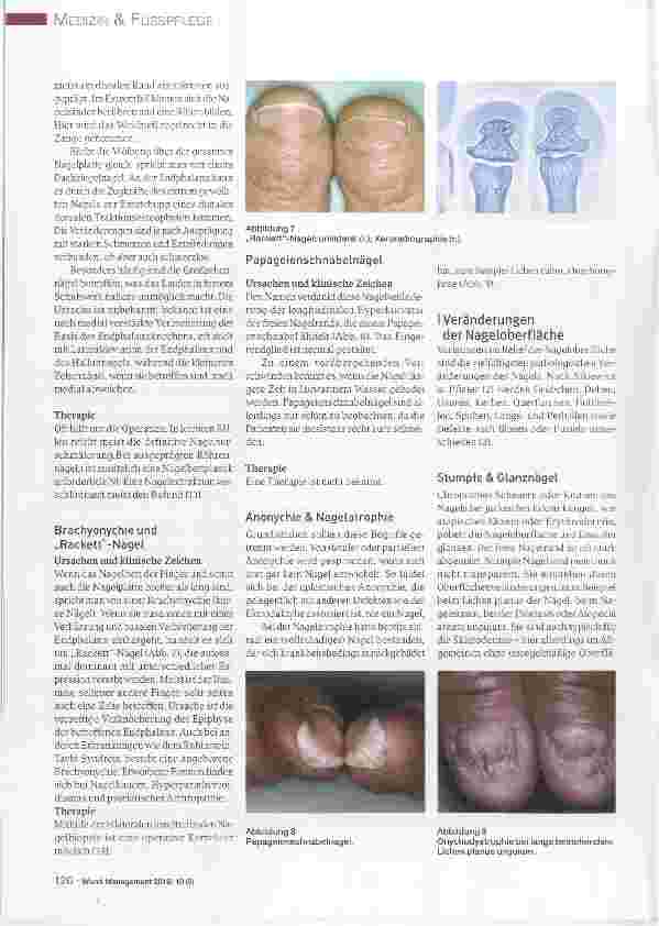 Vorschauseite 3: Ursachen und Therapie von Nagelerkrankungen