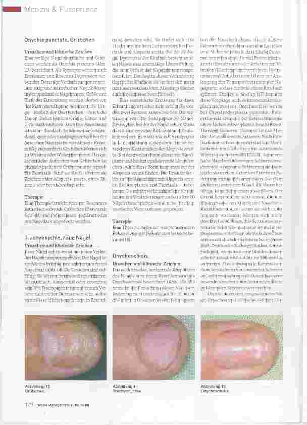 Vorschauseite 5: Ursachen und Therapie von Nagelerkrankungen