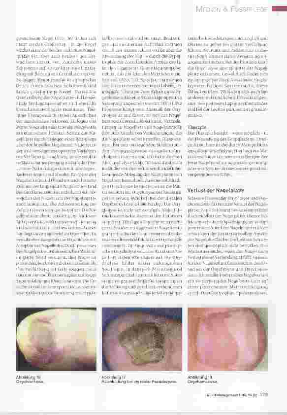Vorschauseite 6: Ursachen und Therapie von Nagelerkrankungen