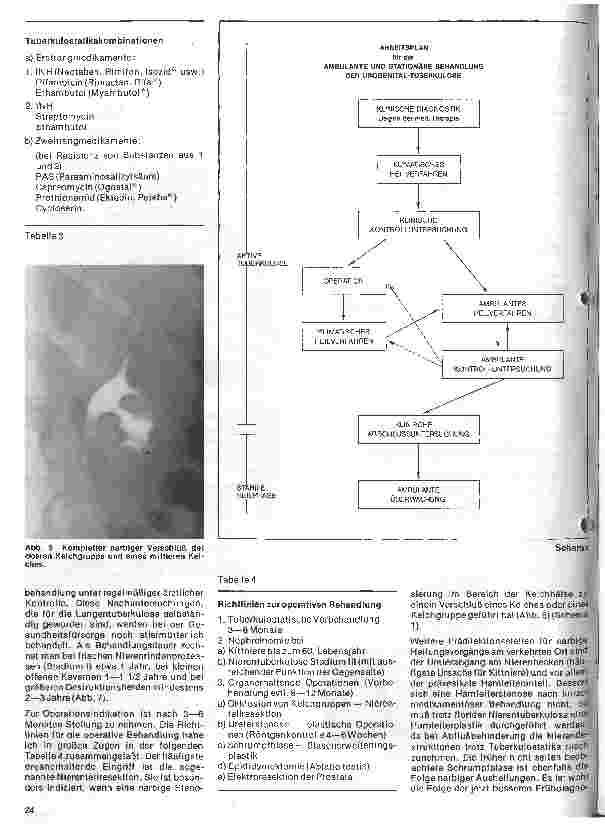 Vorschauseite 3: Urologie 8. Folge: Diagnostik und Therapie der Urogenitaltuberkulose