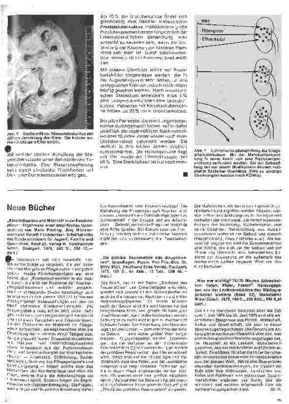 Vorschauseite 4: Urologie 8. Folge: Diagnostik und Therapie der Urogenitaltuberkulose