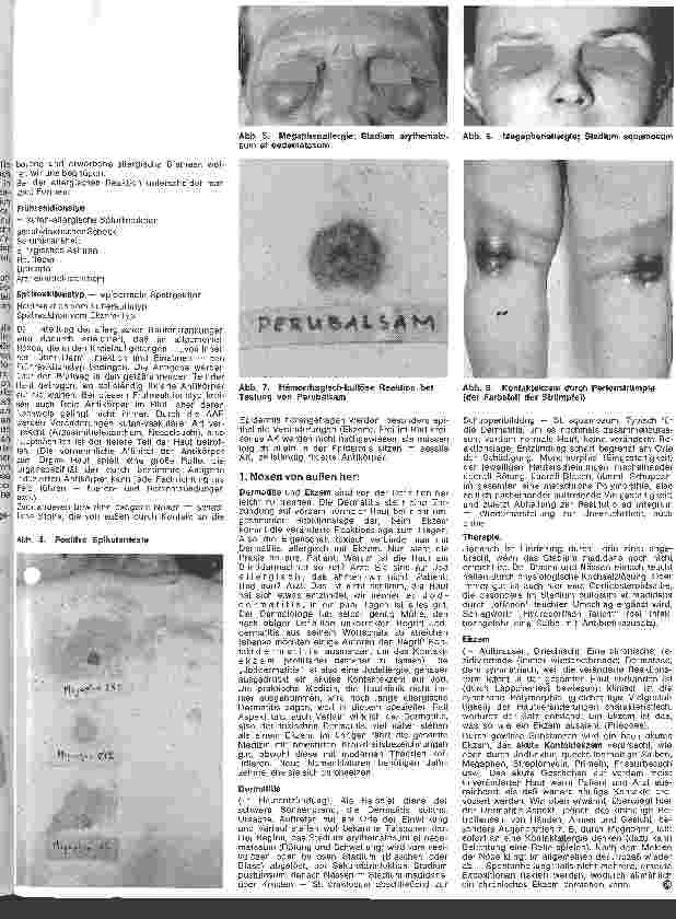 Vorschauseite 2: Der hautkranke Patient 4. Folge: Spezielle Dermatologie: Ekzeme und Unverträglichkeitsreaktion