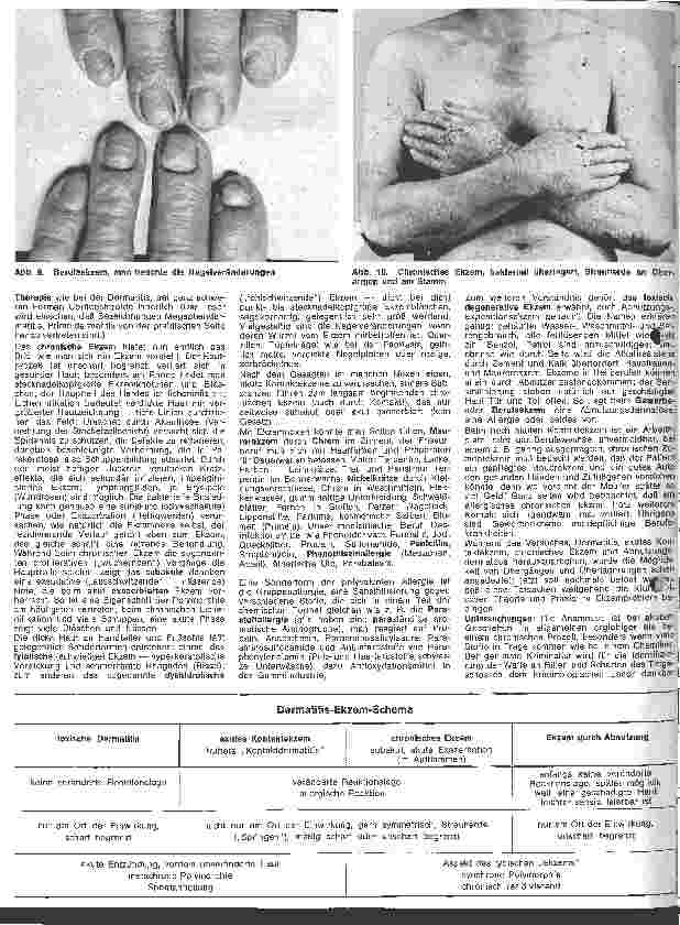 Vorschauseite 3: Der hautkranke Patient 4. Folge: Spezielle Dermatologie: Ekzeme und Unverträglichkeitsreaktion