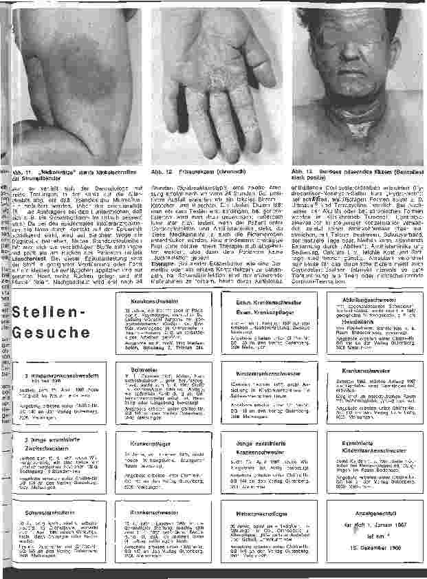 Vorschauseite 4: Der hautkranke Patient 4. Folge: Spezielle Dermatologie: Ekzeme und Unverträglichkeitsreaktion