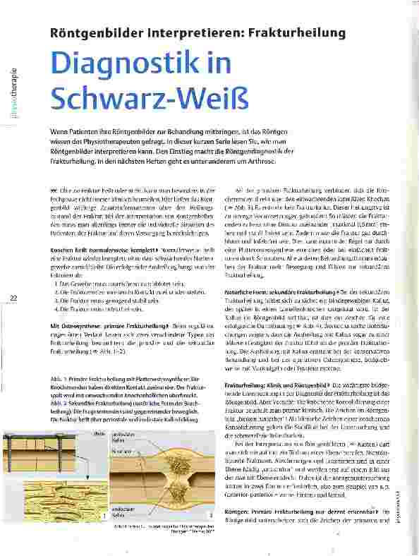 Vorschauseite 1: Röntgenbilder interpretieren: Frakturheilung Diagnostik in Schwarz-Weiß