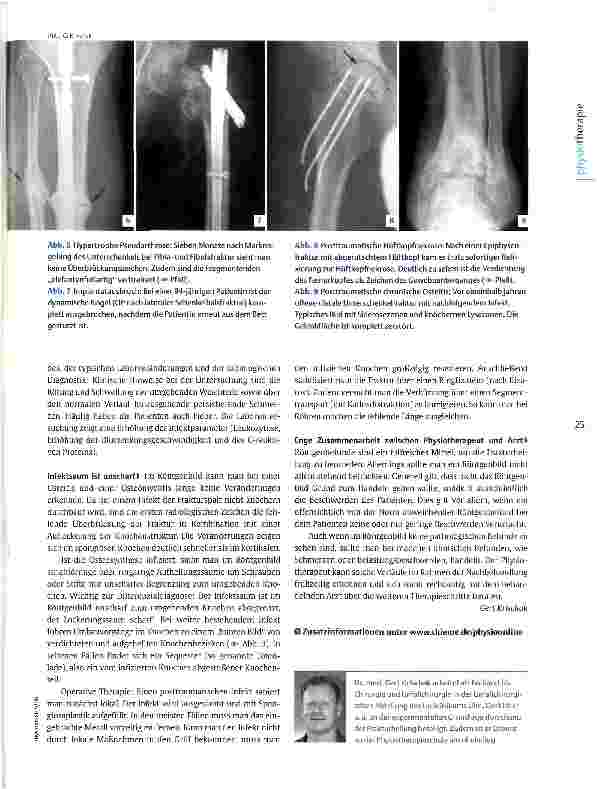 Vorschauseite 4: Röntgenbilder interpretieren: Frakturheilung Diagnostik in Schwarz-Weiß