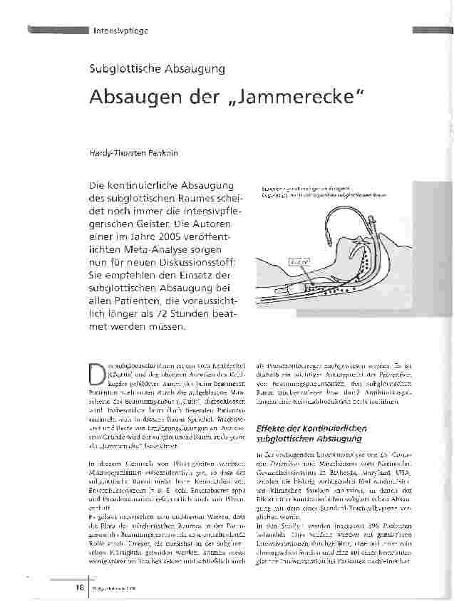 Vorschauseite 1: Subglottische AbsaugungAbsaugen der Jammerecke