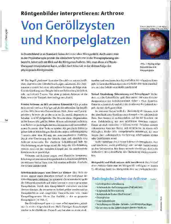 Vorschauseite 1: Röntgenbilder interpretieren: ArthroseVon Geröllzysten und Knorpelglatzen