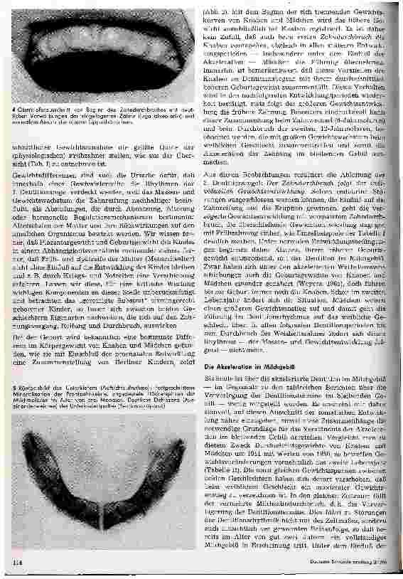 Vorschauseite 4: Der erste Zahndurchbruch und der Dentitionsrhytmus im Milchgebiß