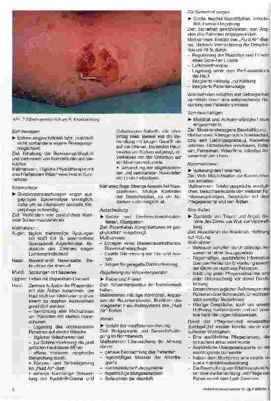 Vorschauseite 3: Pflege eines Kindes mit einem arzneimittelinduzierten Lyell-Syndrom (toxische epidermale Nekrylose)