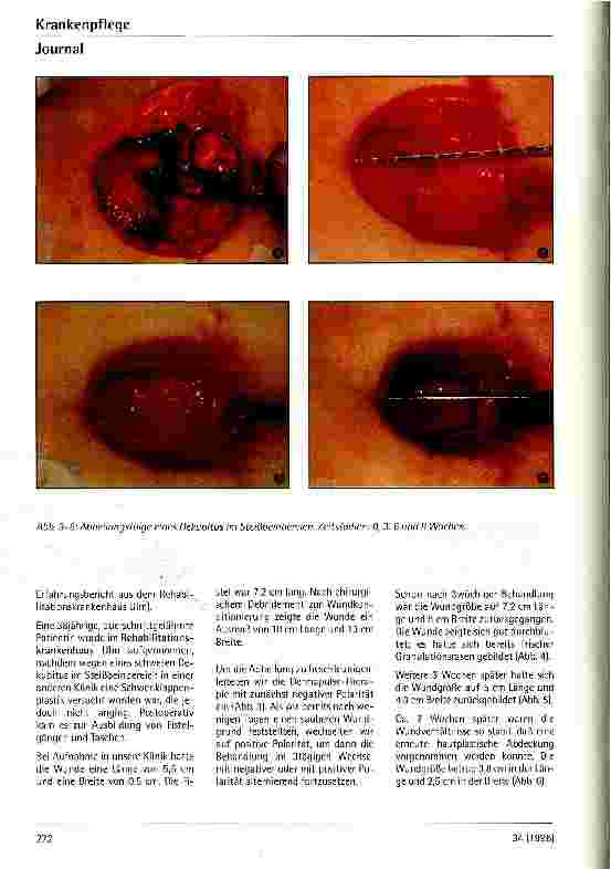 Vorschauseite 3: Über die Anwendung gepulster elektrischer Stimulation bei der Therapie von Dekubitalulcera