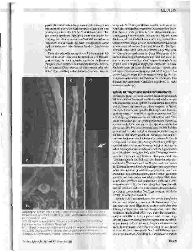 Vorschauseite 3: Differenzialdiagnose der akuten und subakuten nichttraumatischen Querschnittslähmungen