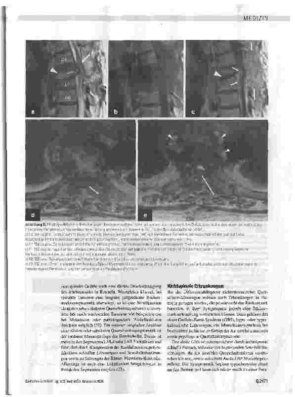 Vorschauseite 5: Differenzialdiagnose der akuten und subakuten nichttraumatischen Querschnittslähmungen