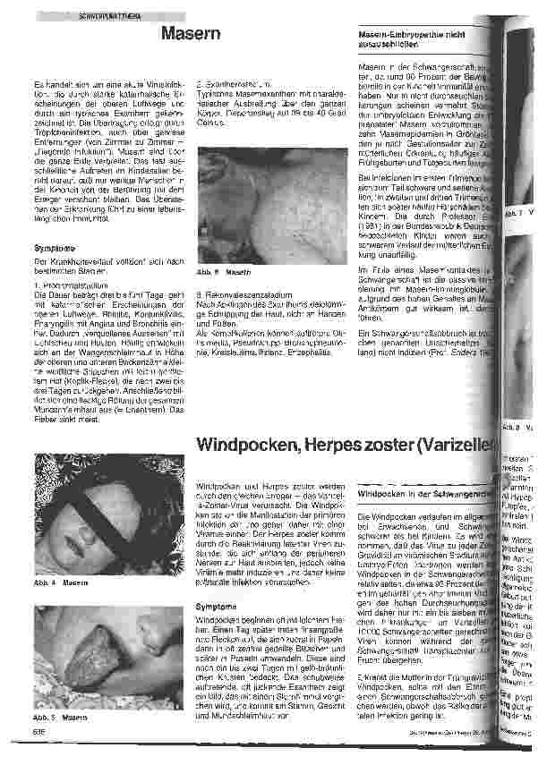 Vorschauseite 3: Virusinfektionen in der Schwangerschaft und in der Periatalperiode