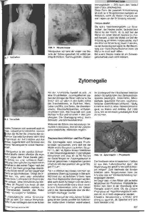 Vorschauseite 4: Virusinfektionen in der Schwangerschaft und in der Periatalperiode