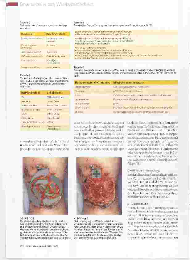 Vorschauseite 4: Standards des ICW e. V. für die Diagnostik und Therapie chronischer Wunden