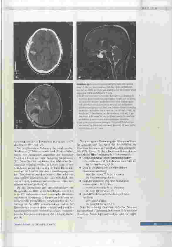 Vorschauseite 5: Akutes Schädel-Hirn-Trauma mit Bewusstlosigkeit