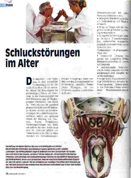Vorschauseite 1: Schluckstörungen im Alter
