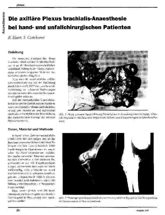 Vorschauseite 1: Die axilläre Plexus brachialis-Anaesthesie bei handund unfallchirurgischen Patienten