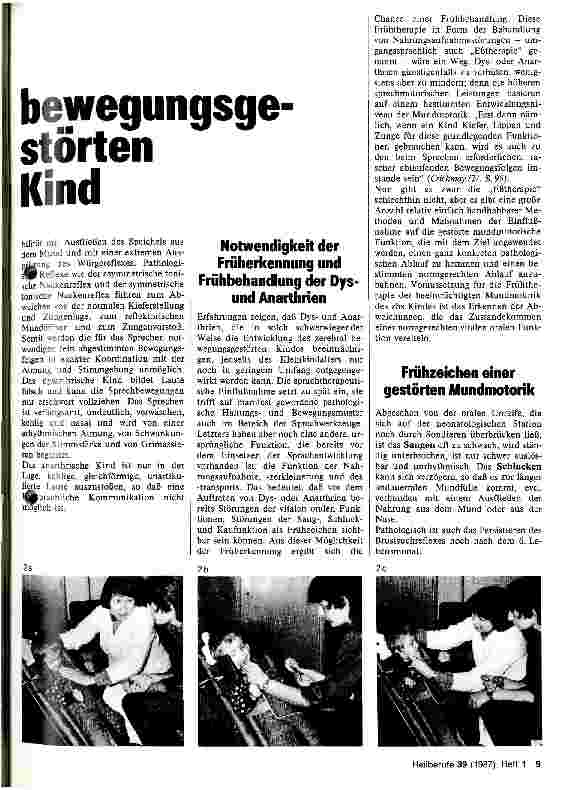 Vorschauseite 2: Eßtherapiebeim zerebral bewegungsgestörten Kind