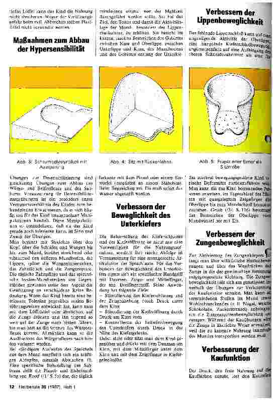 Vorschauseite 5: Eßtherapiebeim zerebral bewegungsgestörten Kind