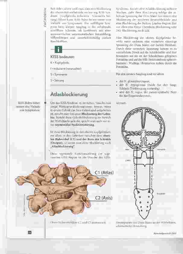 Vorschauseite 2: Schreibabys und das KiSS-Syndronn Strukturelle Probleme als Ursache
