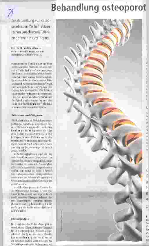 Vorschauseite 1: Behandlung osteoporotosteoporotischer Wirbelfrakturen