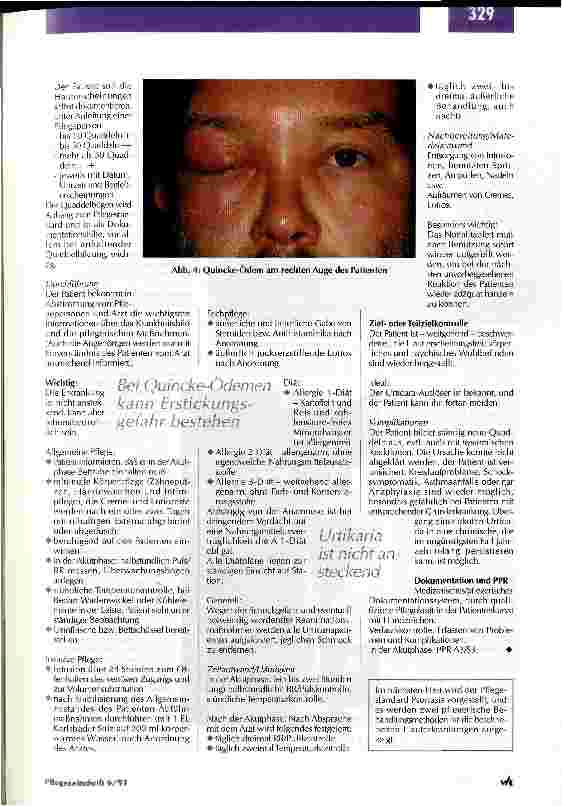 Vorschauseite 5: Pathologische Hautreaktionen können Hinweis auf eine systemische Erkrankung sein Pflegestandards und Behandlungsmethoden in der Dermatologie/Teil 1