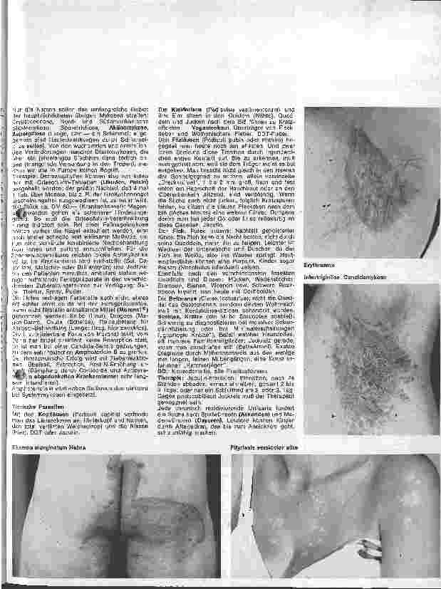 Vorschauseite 2: Der hautkranke Patient 12. Folge: Spezielle Dermatologie: Erregerbedingte Hauterkrankungen: Pilze 2. Teil