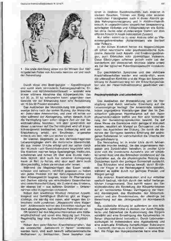 Vorschauseite 2: Die Pubertätsmagersucht
