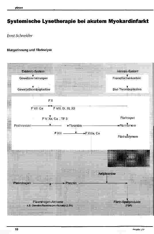 Vorschauseite 1: Systemische Lysetherapie bei akutem Myokardinfarkt