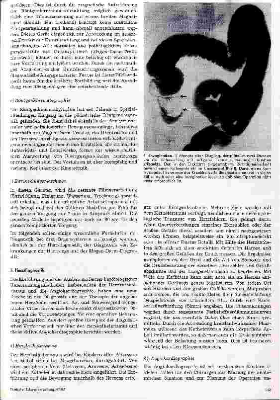Vorschauseite 5: Fortschritte auf dem Gebiet der Kinderröntgenologie