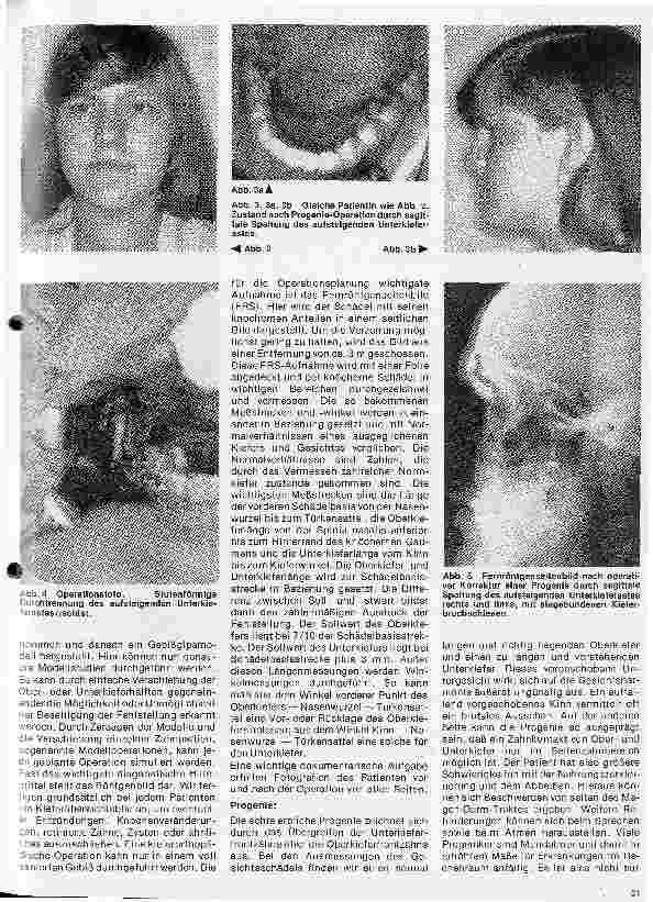 Vorschauseite 2: Zahn-Mundund Kieferchirurgie 12. Folge: (Schluß) Kieferorthopädische Chirurgie