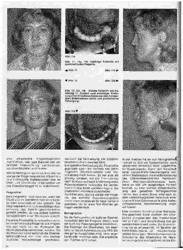 Vorschauseite 5: Zahn-Mundund Kieferchirurgie 12. Folge: (Schluß) Kieferorthopädische Chirurgie