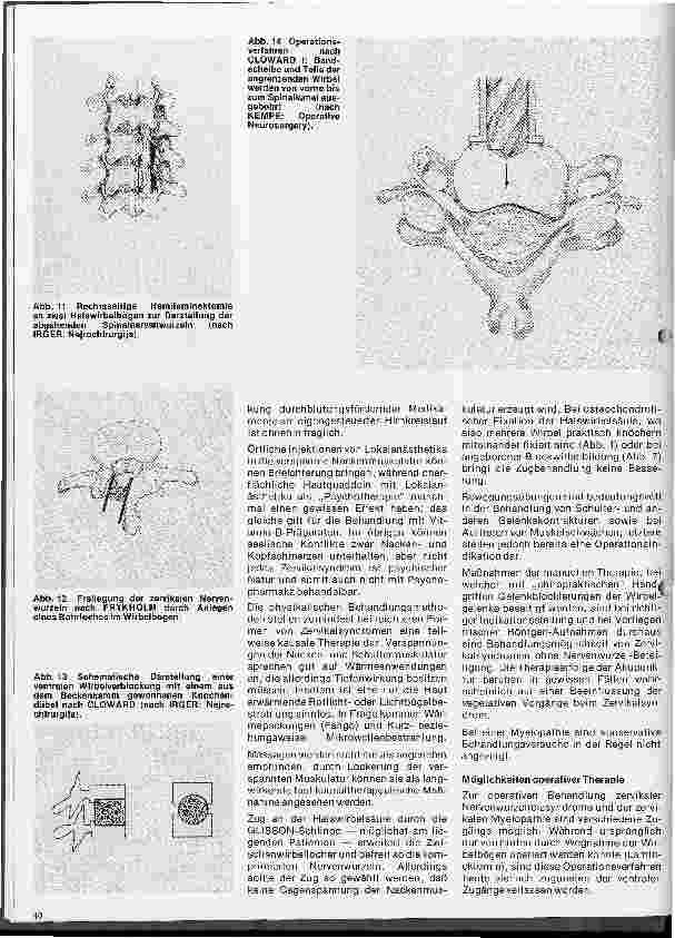 Vorschauseite 5: Themen aus der Neurochirurgie 5. Folge: Das Zervikalsyndrom
