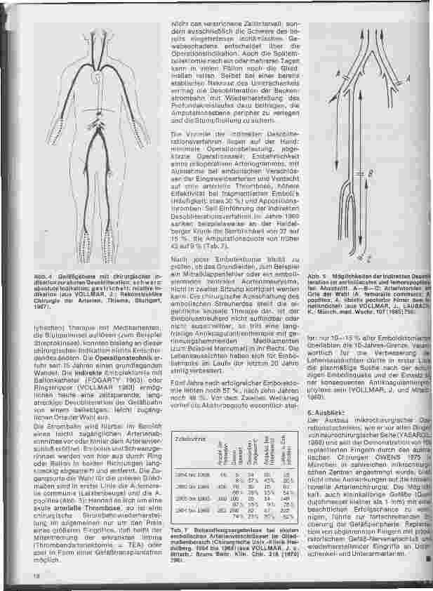 Vorschauseite 4: Aktuelles aus der Gefäßchirurgie 1. Folge: Akute Gefäßnotfälle