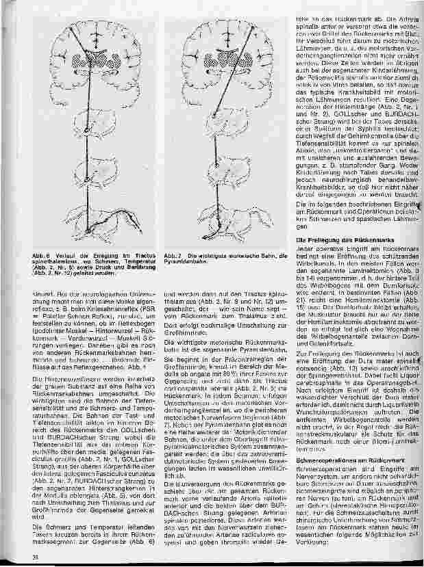 Vorschauseite 3: Themen aus der Neurochirurgie 7. Folge: Operationen am Rückenmark