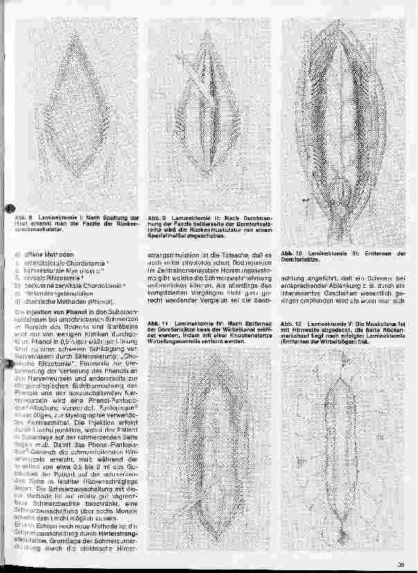Vorschauseite 4: Themen aus der Neurochirurgie 7. Folge: Operationen am Rückenmark