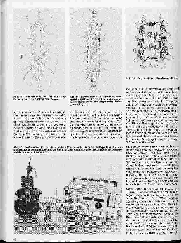 Vorschauseite 5: Themen aus der Neurochirurgie 7. Folge: Operationen am Rückenmark