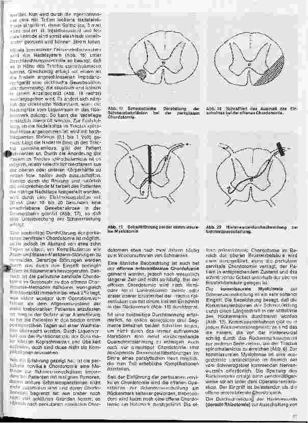 Vorschauseite 6: Themen aus der Neurochirurgie 7. Folge: Operationen am Rückenmark