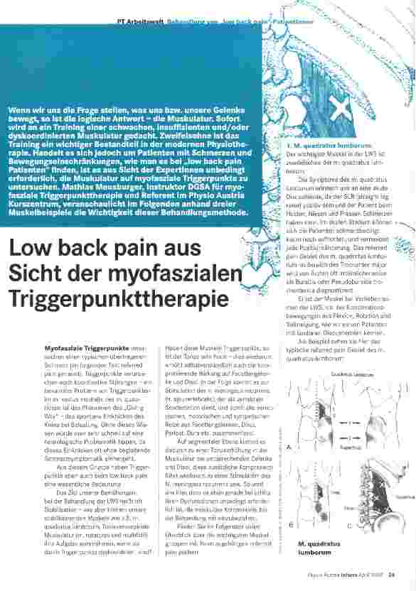 Vorschauseite 1: Low back pain aus Sicht der myofaszialen Triggerpunkttherapie