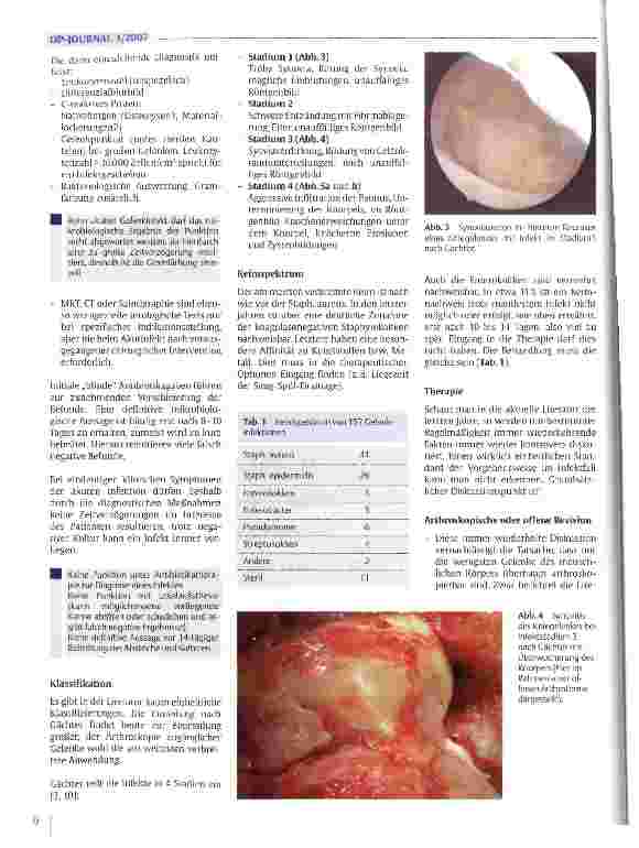 Vorschauseite 3: Die arthroskopische Behandlung des frühen Gelenkinfektes