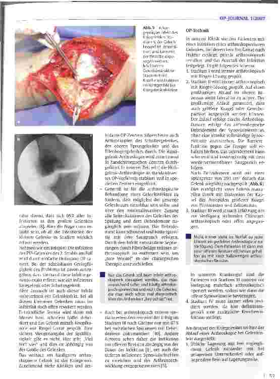 Vorschauseite 4: Die arthroskopische Behandlung des frühen Gelenkinfektes