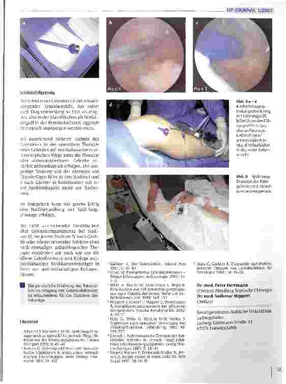 Vorschauseite 6: Die arthroskopische Behandlung des frühen Gelenkinfektes