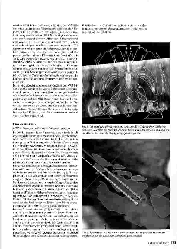 Vorschauseite 2: Darstellung multimodaler Daten des Gehirns