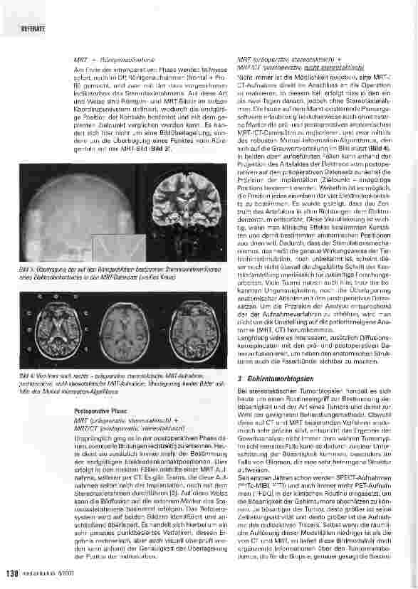 Vorschauseite 3: Darstellung multimodaler Daten des Gehirns