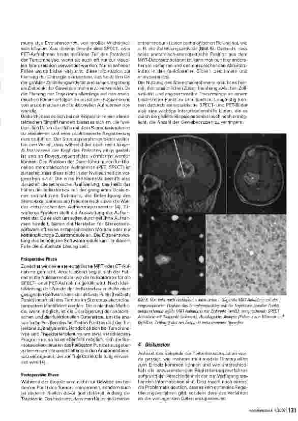 Vorschauseite 4: Darstellung multimodaler Daten des Gehirns