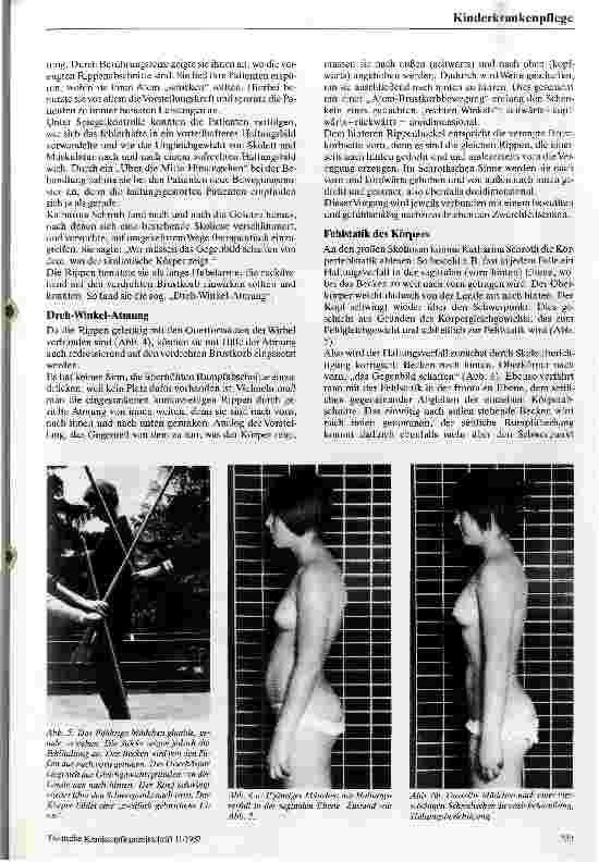 Vorschauseite 3: Die dreidemensionale Skoliosebehandlung nach Schroth Eine konservative Behandlungsweise der Rückgratverkrümmung