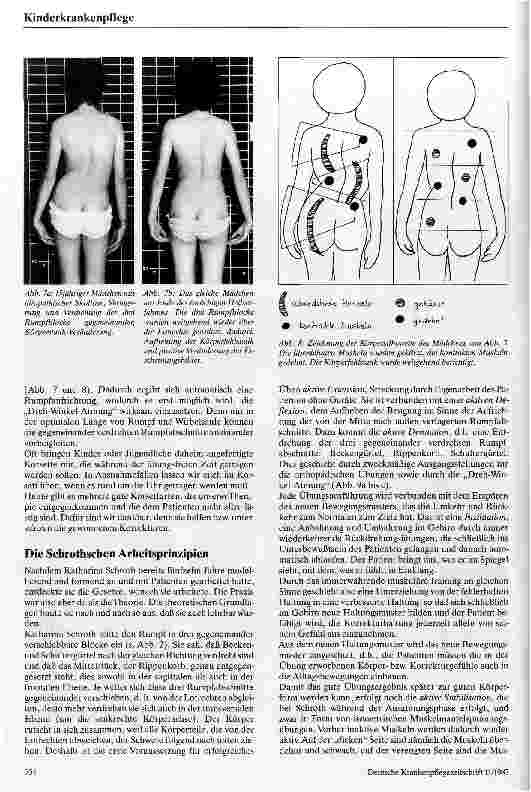 Vorschauseite 4: Die dreidemensionale Skoliosebehandlung nach Schroth Eine konservative Behandlungsweise der Rückgratverkrümmung